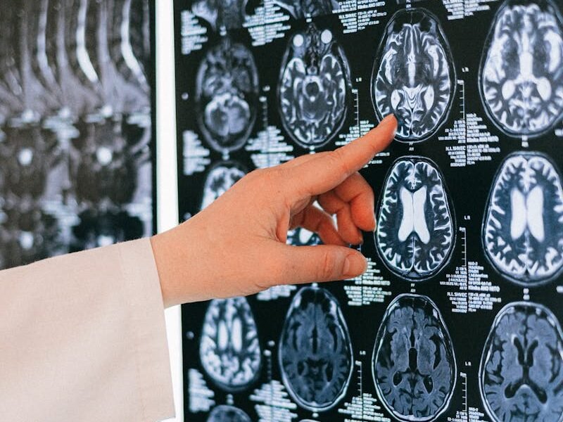 duracion thc cerebro